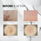 VT cosmetics - Reedle Shot 100