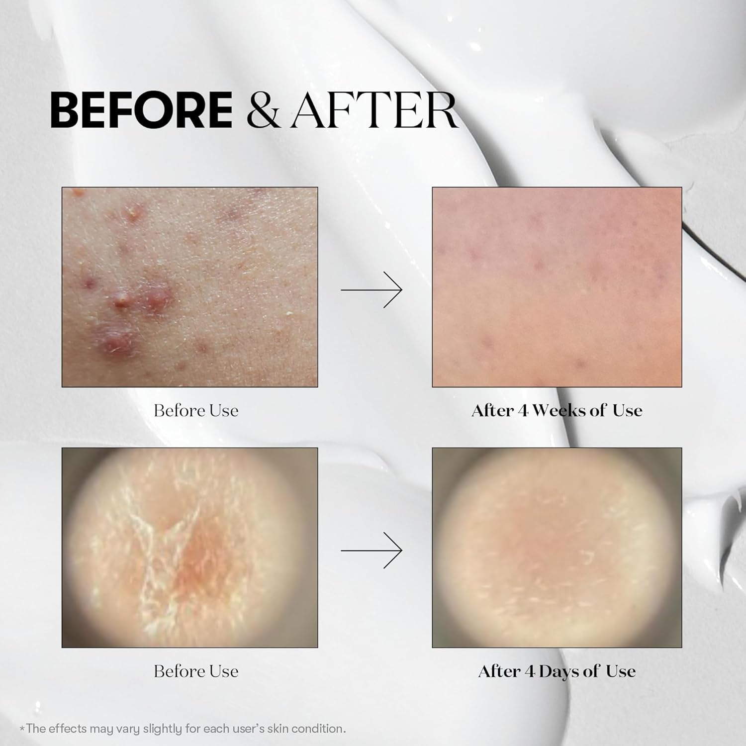 VT cosmetics - Reedle Shot 100