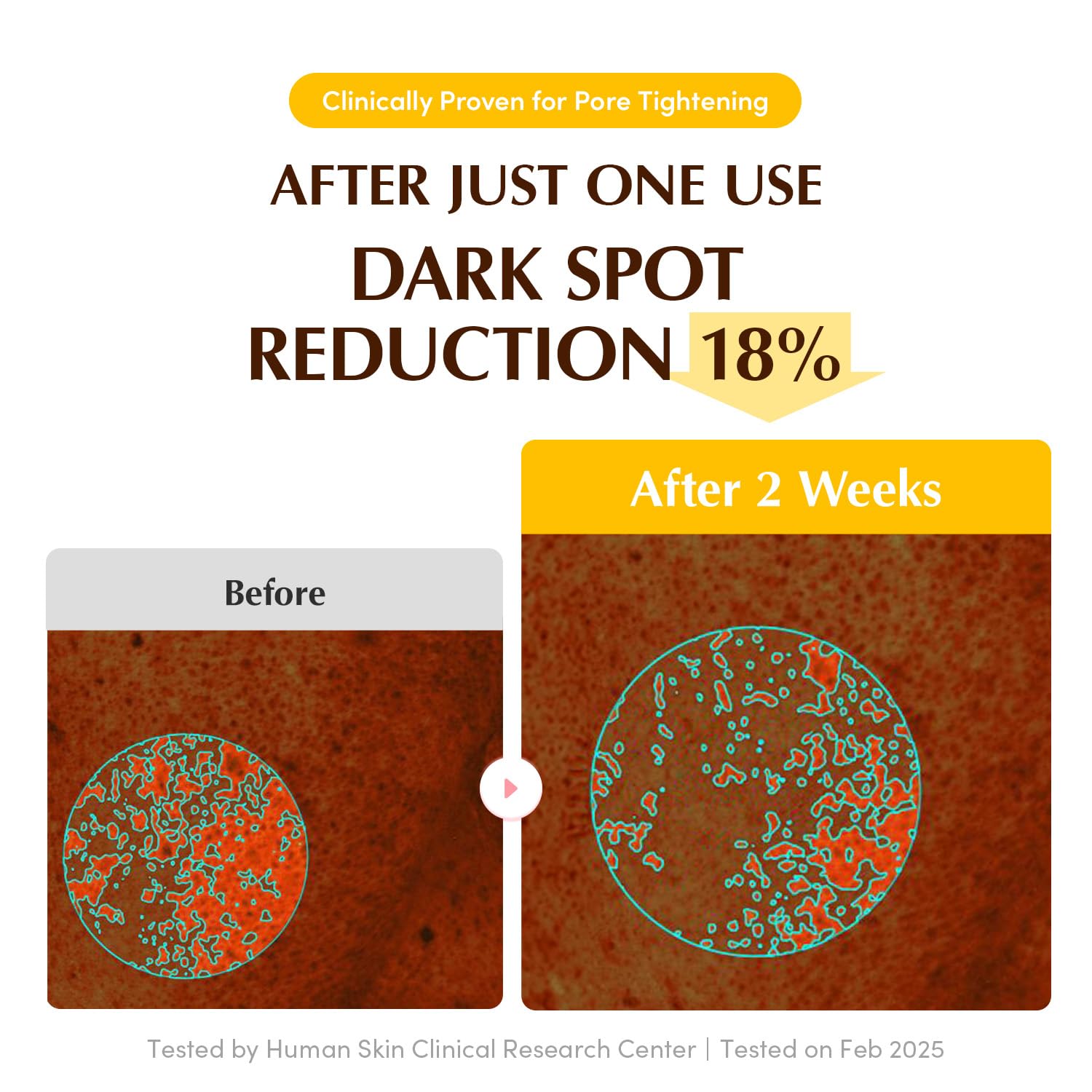 EQQUALBERRY - Collagen Glow up Hydrogel Mask Set