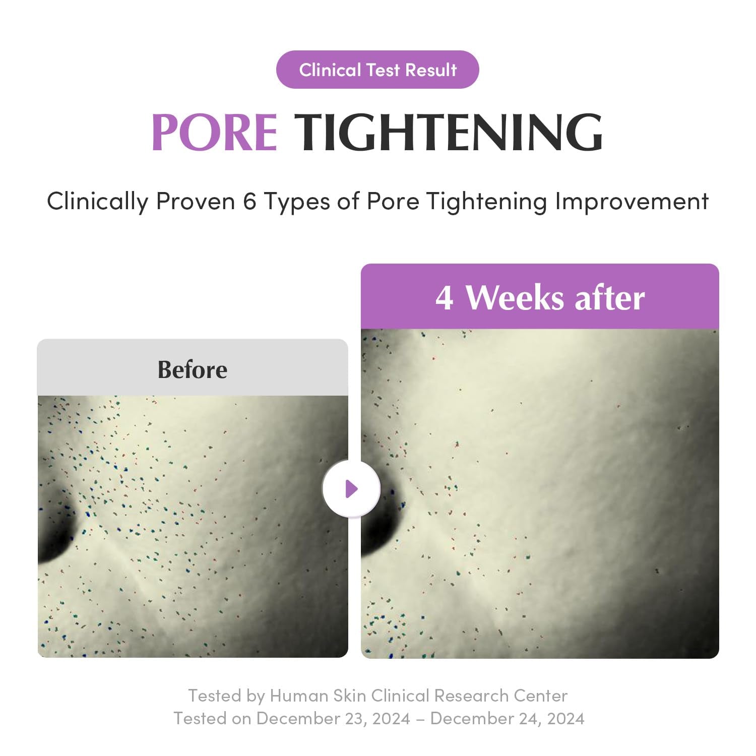 EQQUALBERRY - Purple PDRN Pore Minimizing Serum