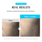 EQQUALBERRY - Swimming Pool Toner