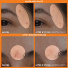 innisfree - Vitamin C Green Tea Enzyme Brightening Serum 30ml